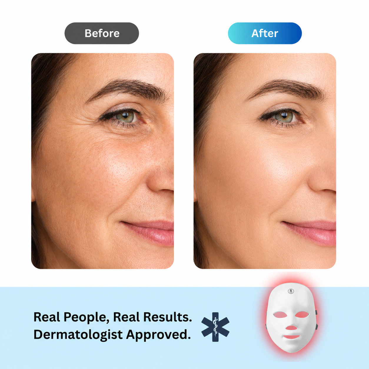 Glowing Skin Red Light LED Mask Bonus (Neck Red Light Strip)