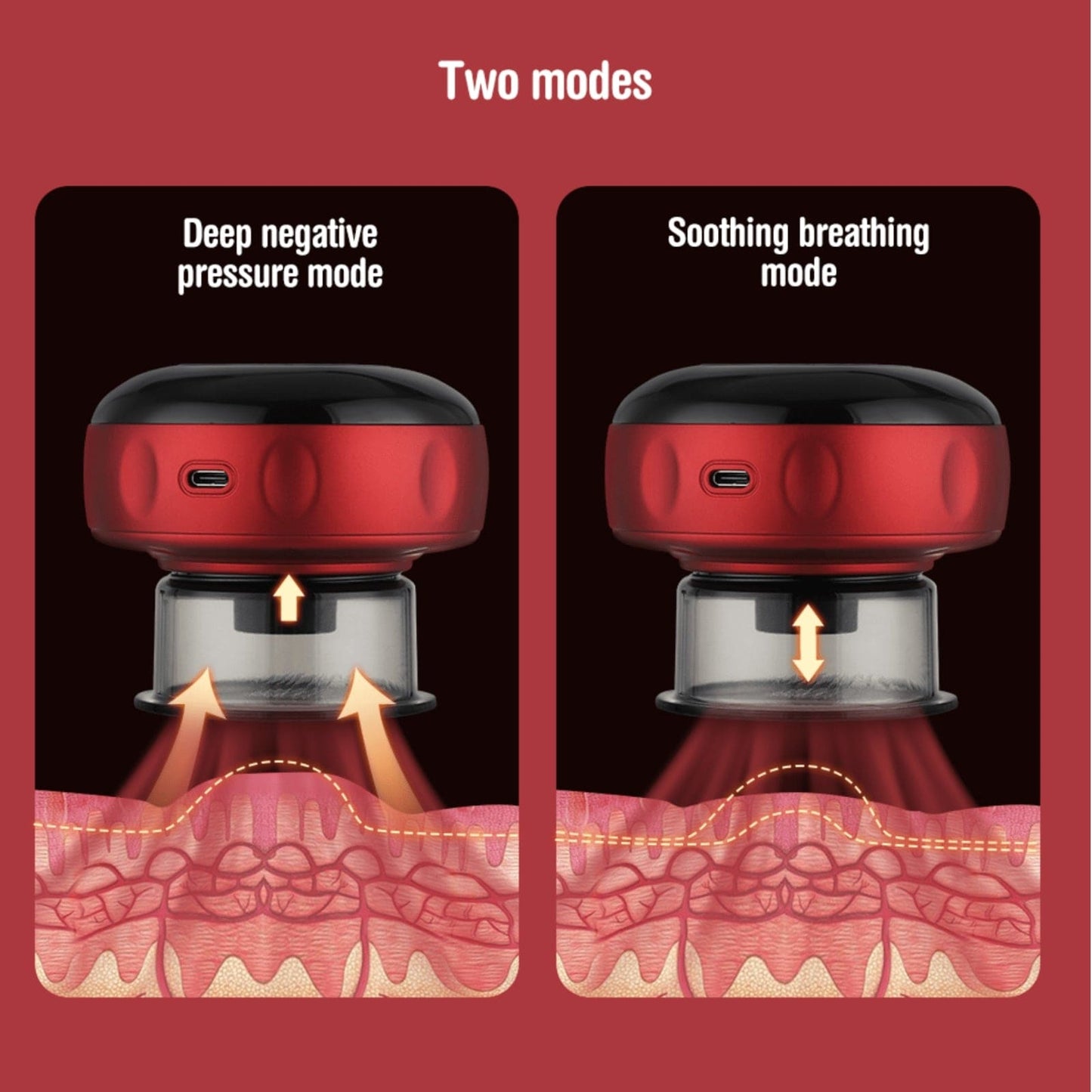 Electric Vacuum Cupping Massager